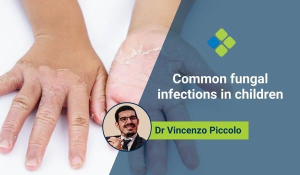 Image showcasing Common fungal infections in children